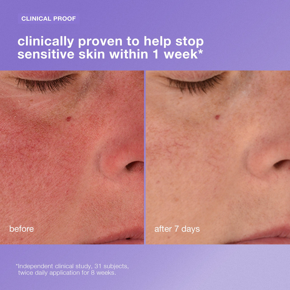Stabilizing Repair Cream — formula detail