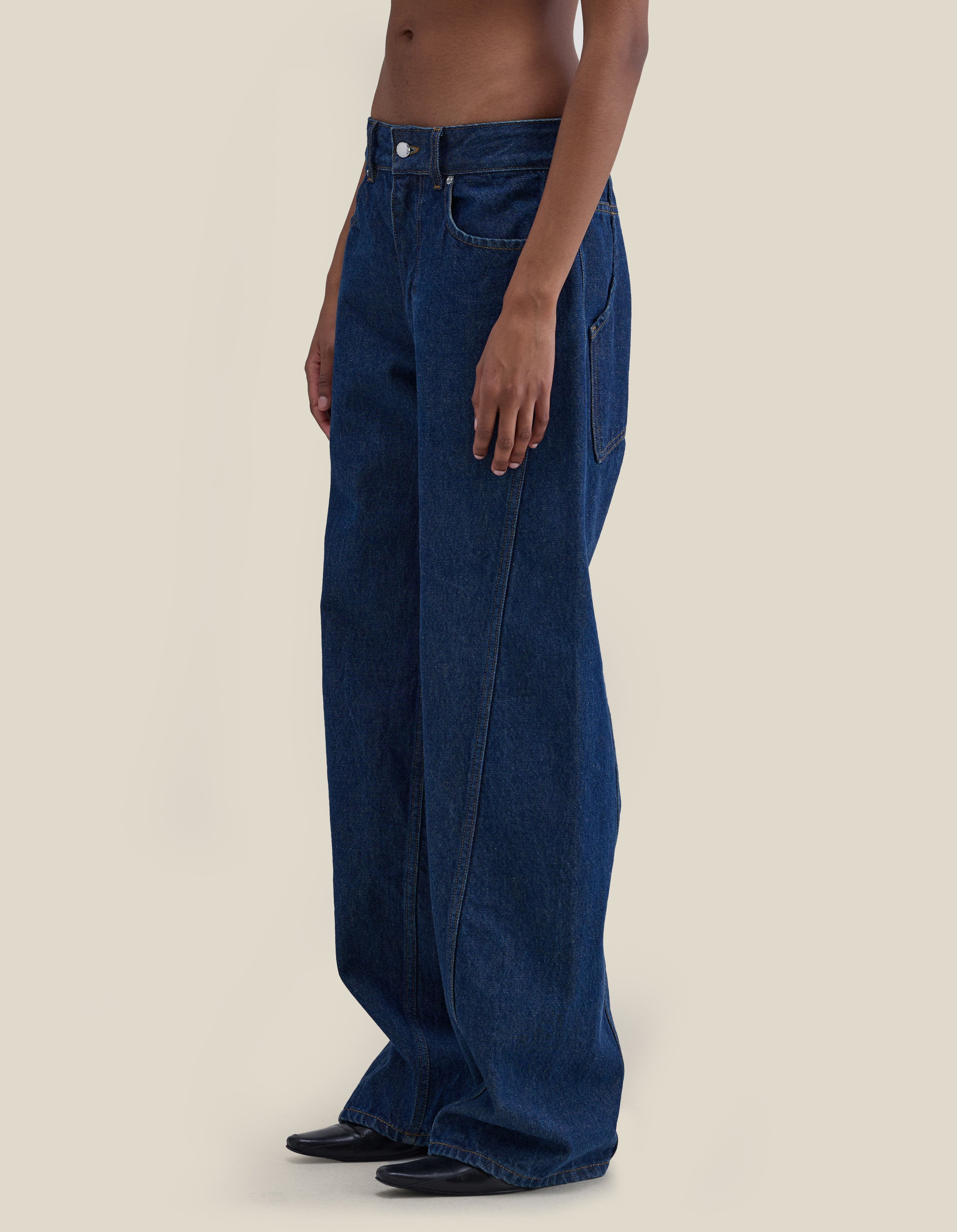 side bowed-leg view