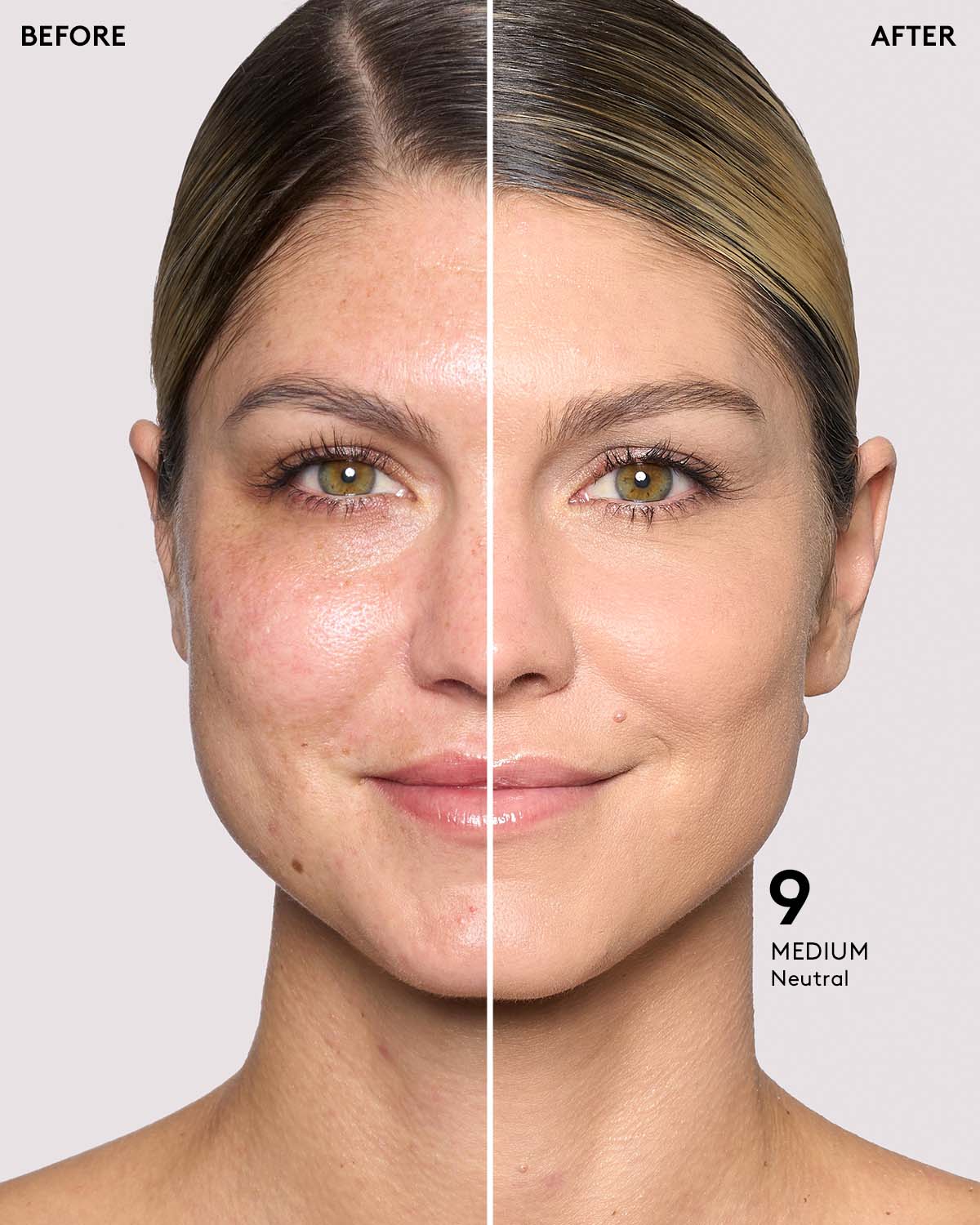 before-after card